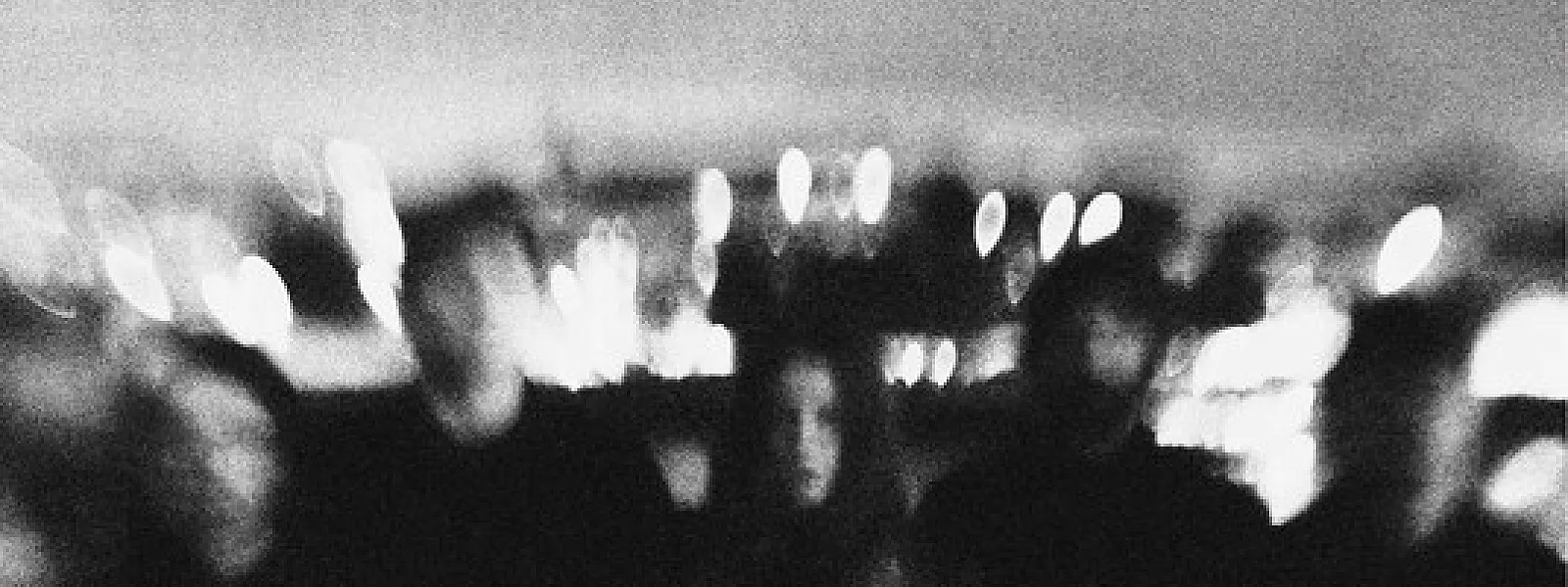 Black Bile