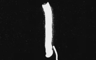 Infinite Bisous