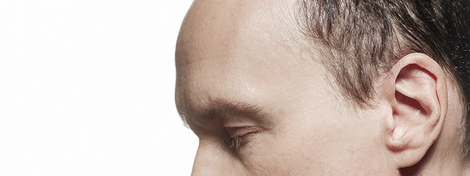 David Linx