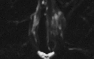 Hulder